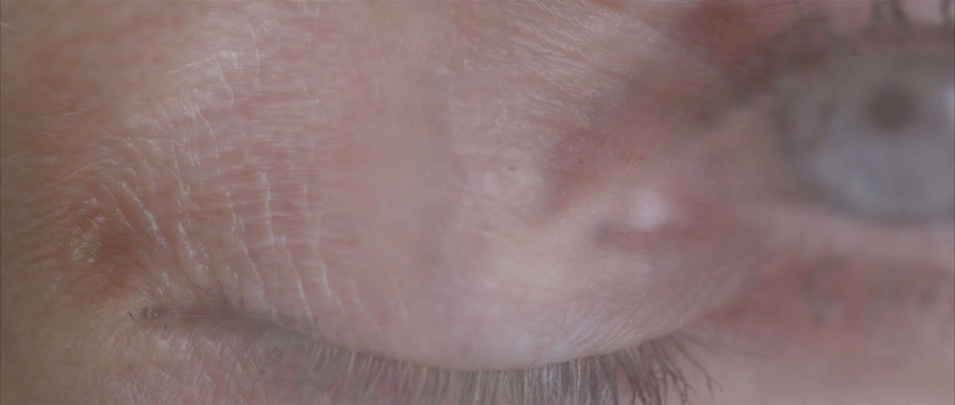 Closed eye